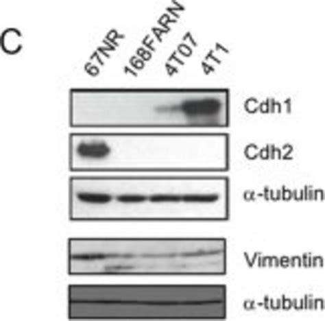 Monoclonal Anti Vimentin Antibody Produced In Mouse