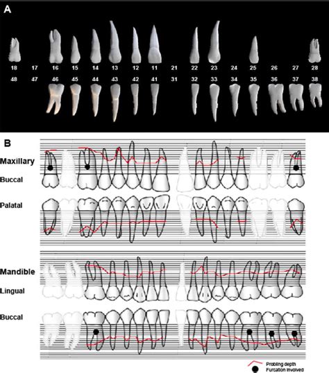 Fdi Palmer And Universal Tooth Numbering Systems For 47 Off