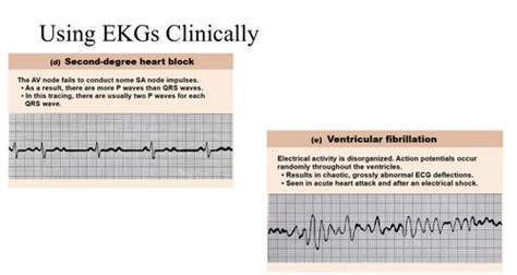 Ekg And The Cardiac Cycle Flashcards Quizlet