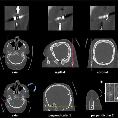 Direct Reconstructions In The Ct Scan Suite And Multiplanar Download Scientific Diagram