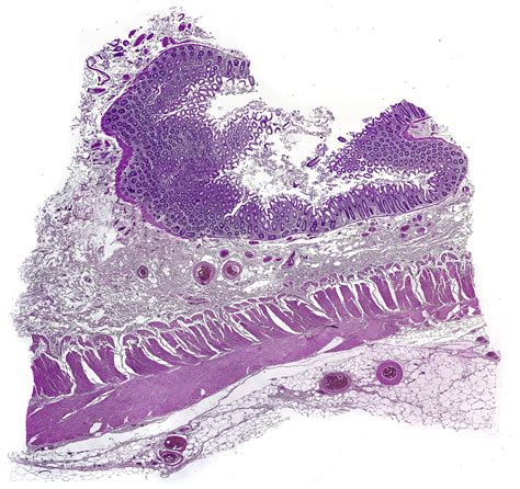 Digestive System Histology And Histophathology