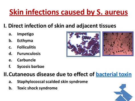 Bacterial infection of the skin