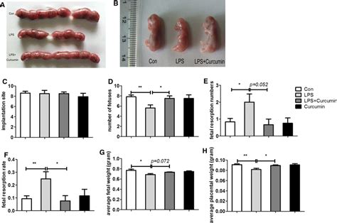 Curcumin Improves Pregnancy Outcomes In Lps Induced Preeclamptic Mice