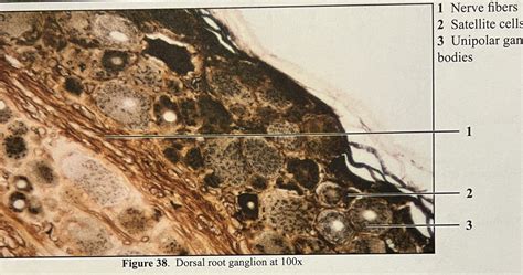 Dorsal root ganglion Diagram | Quizlet