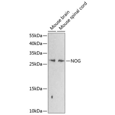 Anti Noggin Antibody A17228