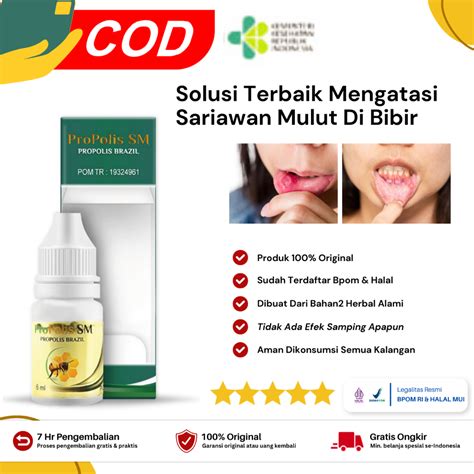 Jual Propolis SM Obat Sariawan Mulut Di Bibir DI Lidah Bibir Pecah