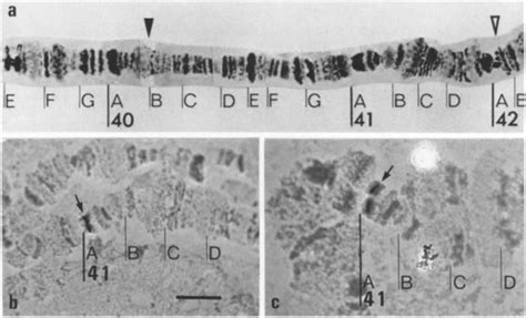 A Section From The Polytene Chromosome Map Of Chrysomya Rufifacies