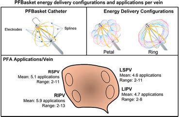 PO 04 160 FIRST IN HUMAN CLINICAL USE OF A NOVEL PULSED FIELD ABLATION