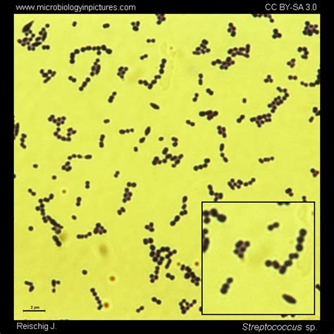 Streptococci Gram Stain