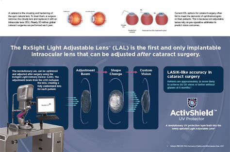 Rxsight First And Only Customizable Intraocular Lens Nasdaq Rxst