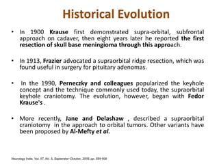 Supraorbital Craniotomy Ppt