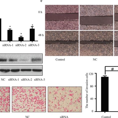 Effects Of Integrin Inhibition On The Invasiveness Of Laryngeal