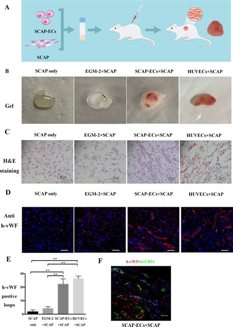 Conversion Of Stem Cells From Apical Papilla Into Endothelial Cells By