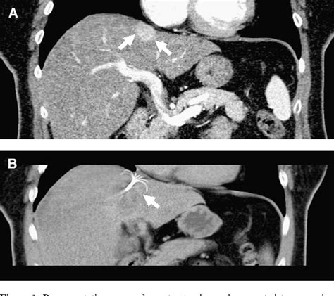 Figure 1 From Vascular And Interventional Radiology Radiologie