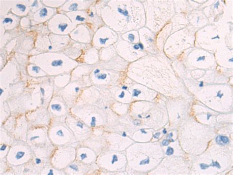 Btk Anti Btk Rabbit Polyclonal Antibody