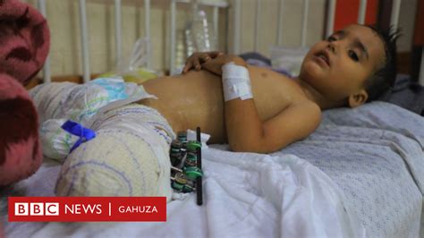 Israel Hamas Umubabaro W Abana B Imfuvyi Zakomeretse Zisigaye Ari