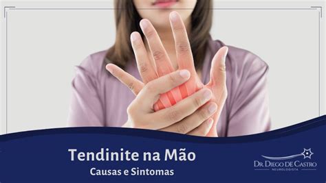 Tendinite na Mão Causas e Sintomas Dr Diego De Castro Neurologista