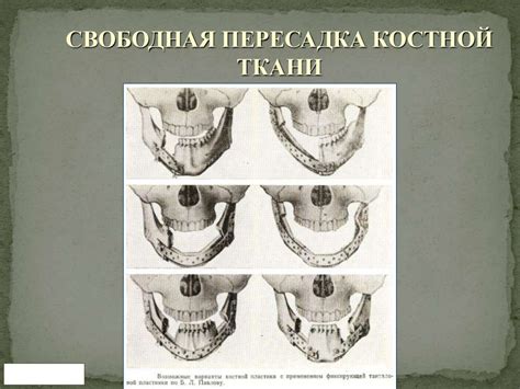 Пластика местными тканями - презентация онлайн