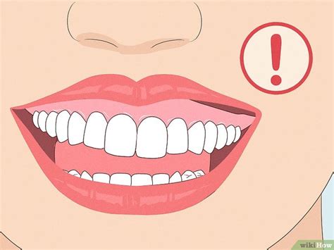 How to Heal a Bitten Tongue: First Aid & Treatment