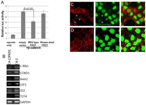 A PKD1 inhibits β catenin TCF transcription activity Topflash assay