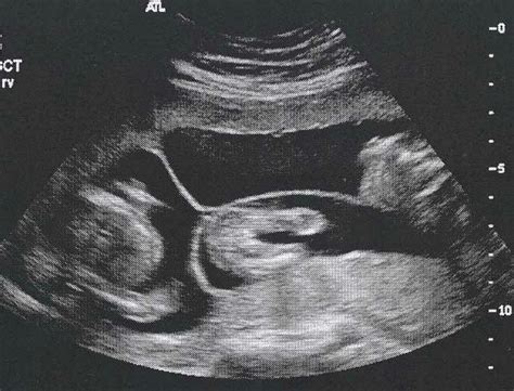 How To Determine Sex Of Baby Big Asses Sexy