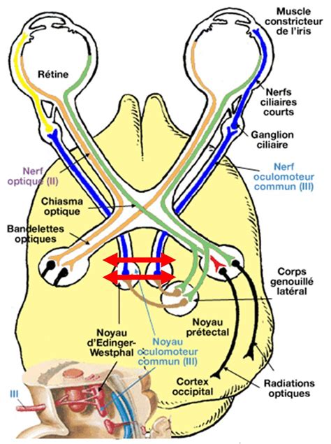 La Mydriase Anisocorie En Neuro R A A Vient D O Ca Veut Dire