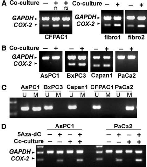 A RT PCR Analysis Of COX 2 MRNA Expression In CFPAC1 And Two