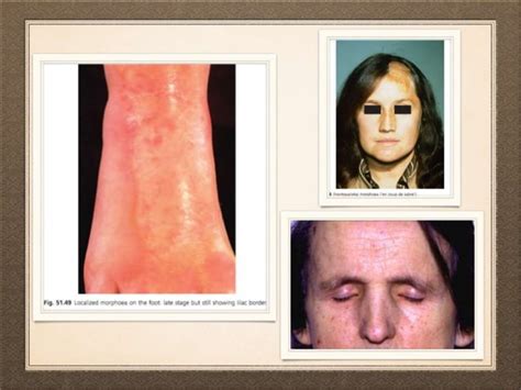 Dermatological Manifestation Of Systemic Diseases PPT