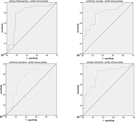 Discriminatory Ct Textural Features In Splenic Infiltration Of Lymphoma