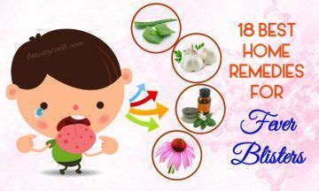 18 Best Home Remedies For Fever Blisters You Should Not Skip