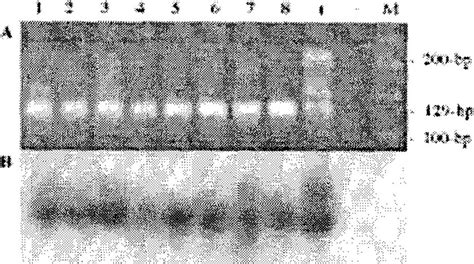 A Representative Ethidium Bromide Stained Agarose Gel Showing