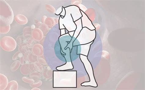 How do you know if you have a blood clot? — Vascular Cures