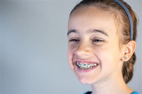 Free Photo Teenage Girl With Braces On Her Teeth Closeup Of A Smile