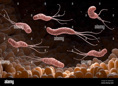 Helicobacter pylori es un bacilo Gram negativo microaerófilo bacteria