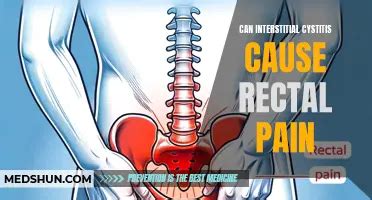 Understanding The Connection Between Oral Sex And Cystitis What You Need To Know MedShun