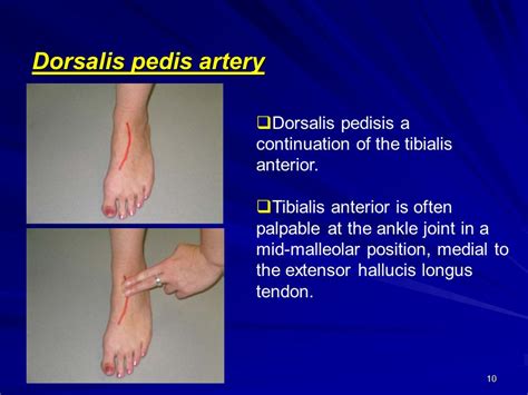 Dorsalis Pedis Pulse / Arteries And Veins Of The Lower Limb Dr ...