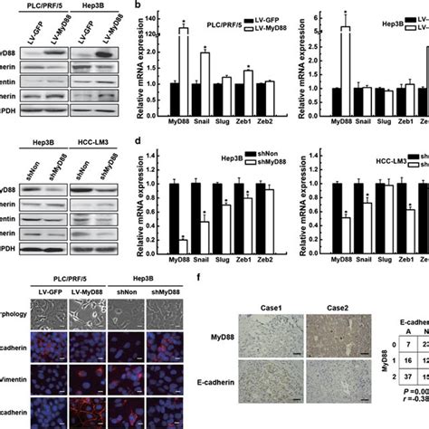 Myd88 Induces Characteristics Of Emt In Hcc Cells A C Western Blot