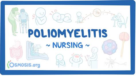 Poliomyelitis Nursing Video And Causes Osmosis