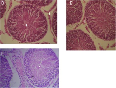 Histological Sections Of Testes Of Sprague Dawley Rats After 8 Weeks