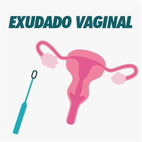 Ac Exudado Vaginal Laboratorio M Dico Samalab