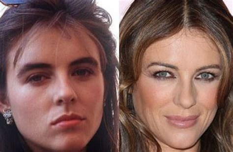 Elizabeth Hurley before and after plastic surgery 15 – Celebrity ...