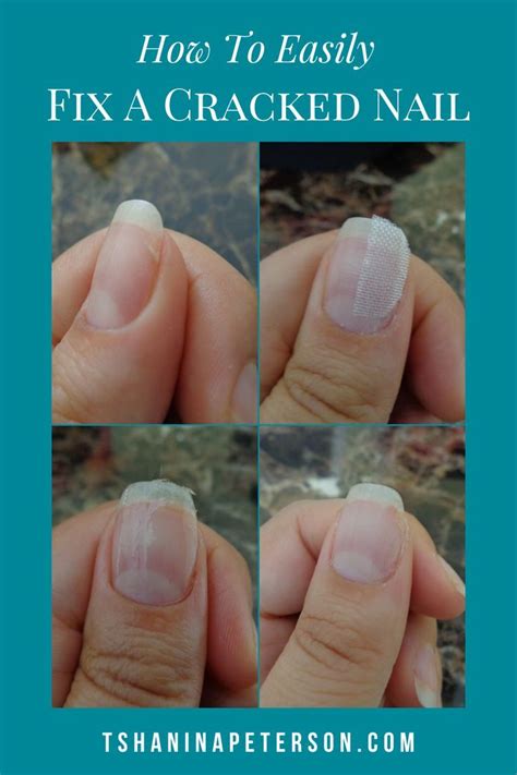 Split Nail Repair For Natural Nails