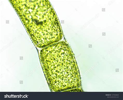 732 Cyanobacteria Under Microscope Images, Stock Photos & Vectors ...