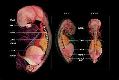 Embryo Anatomy Week 10 Photograph By Anatomical Travelogue Pixels