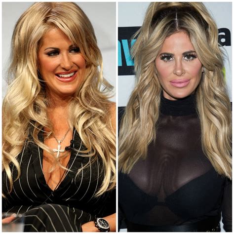 Kim Zolciak Shares Throwback Photo Before Plastic Surgery — See Her Amazing Transformation