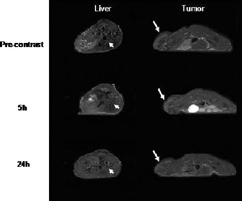 T Weighted Axial Spin Echo Images Through The Abdomen And Lower