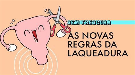 Quais São As Novas Regras Para Laqueadura E Vasectomia E Para Que Esses Pro 16 05 2023 Uol