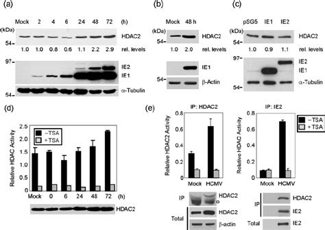 Effects Of HCMV Infection On The HDAC2 Protein Levels And Deacetylation