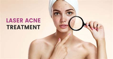 Acne Scar Reduction Treatment In Gurgaon At Best Price In Gurugram Id