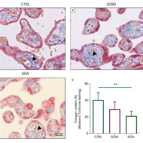 Collagen Deposition Analysis Through Histology In The Three